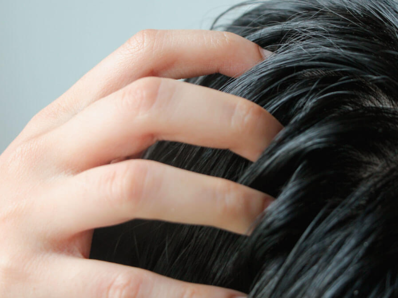 cabello graso