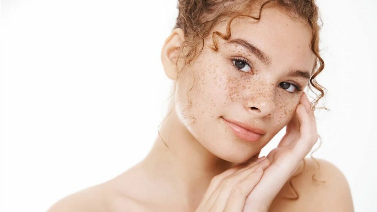 Pecas en la cara: Tipos, remedios y  tratamientos